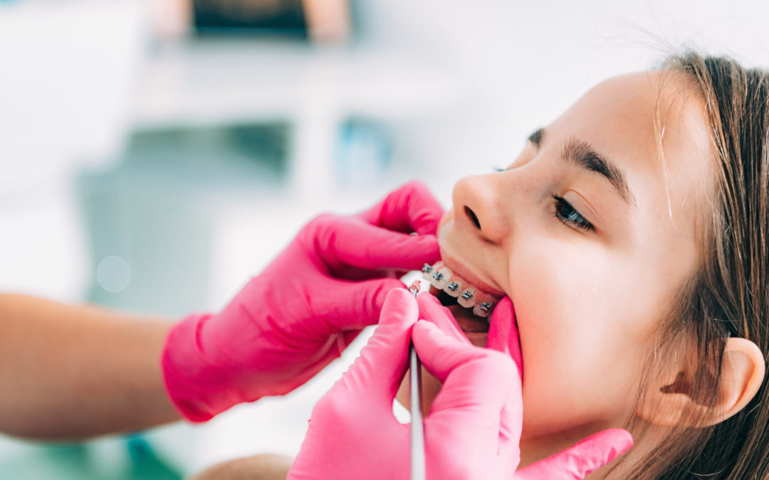 Getting Ready for Your Fort Worth Pediatric Dentist Appointment: How to Talk to Kids About Their First Visit to the Dentist